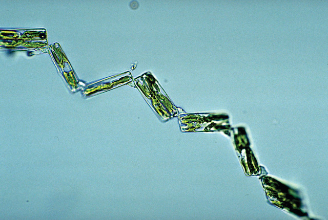 Chain diatomsPLANKTON008
